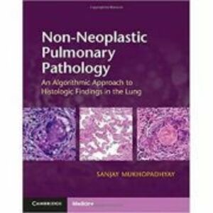 Non-Neoplastic Pulmonary Pathology with Online Resource: An Algorithmic Approach to Histologic Findings in the Lung - Sanjay Mukhopadhyay imagine