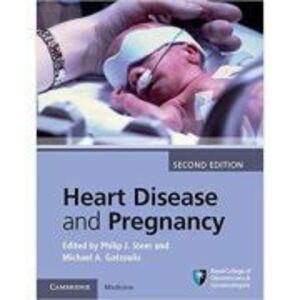 Heart Disease and Pregnancy imagine