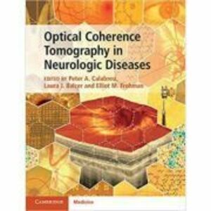 Optical Coherence Tomography in Neurologic Diseases - Peter A. Calabresi, Laura J. Balcer, Elliot M. Frohman imagine