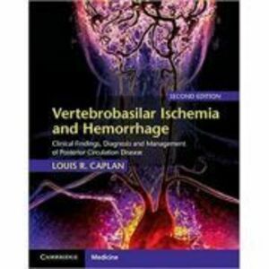 Vertebrobasilar Ischemia and Hemorrhage: Clinical Findings, Diagnosis and Management of Posterior Circulation Disease - Louis R. Caplan imagine