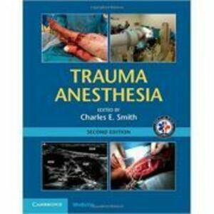 Trauma Anesthesia - Charles E. Smith imagine
