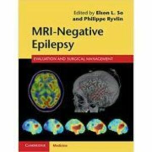 MRI-Negative Epilepsy: Evaluation and Surgical Management - Elson L. So, Philippe Ryvlin imagine