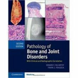 Pathology of Bone and Joint Disorders Print and Online Bundle: With Clinical and Radiographic Correlation - Edward F. McCarthy imagine