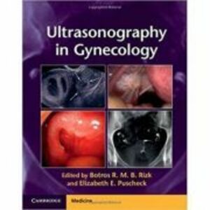 Ultrasonography in Gynecology - Botros R. M. B. Rizk, Elizabeth E. Puscheck imagine