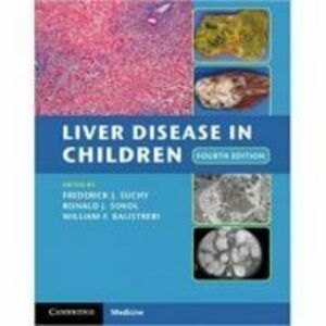 Liver Disease in Children - Frederick J. Suchy, Ronald J. Sokol, William F. Balistreri imagine