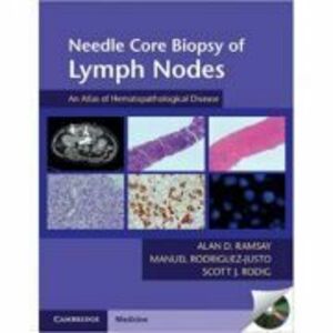 Needle Core Biopsy of Lymph Nodes with DVD-ROM: An Atlas of Hematopathological Disease - Alan D. Ramsay, Manuel Rodriguez-Justo, Scott J. Rodig imagine
