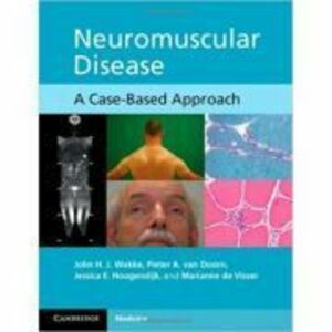 Neuromuscular Disease imagine