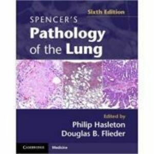 Spencer's Pathology of the Lung 2 Part Set with DVDs - Professor Philip Hasleton MD, Dr Douglas B. Flieder MD imagine