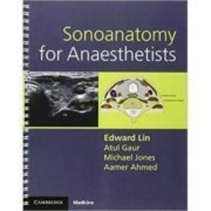 Sonoanatomy for Anaesthetists - Edward Lin, Atul Gaur, Michael Jones, Aamer Ahmed imagine