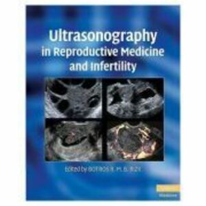 Ultrasonography in Reproductive Medicine and Infertility - Botros R. M. B. Rizk imagine
