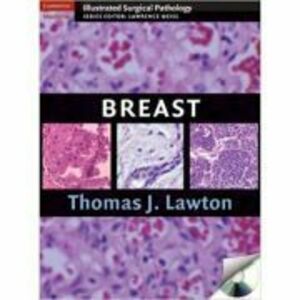 Breast - Thomas J. Lawton MD imagine