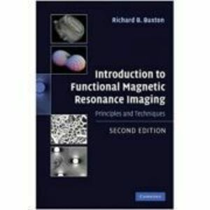 Introduction to Functional Magnetic Resonance Imaging: Principles and Techniques - Richard B. Buxton imagine