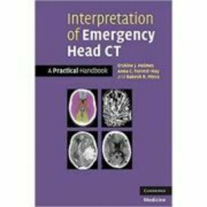 Interpretation of Emergency Head CT: A Practical Handbook - Erskine J. Holmes, Anna C. Forrest-Hay, Dr Rakesh R. Misra imagine