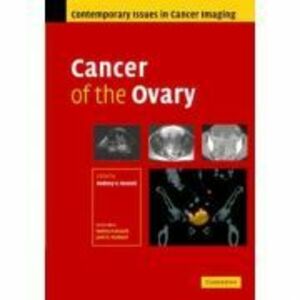 Cancer of the Ovary - Rodney Reznek imagine
