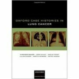 Oxford Case Histories in Lung Cancer - Himender K. Makker, Adam Ainley, Sanjay Popat, Julian Singer, Martin Hayward, Antke Hagena imagine