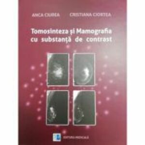 Tomosinteza si Mamografia cu substanta de contrast - Anca Ciurea, Cristiana Ciortea imagine