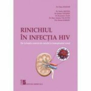 Rinichiul in infectia HIV - Dr Oana Ailioaie imagine