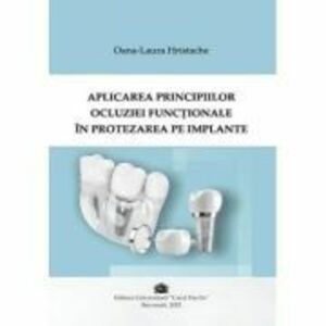 Aplicarea principiilor ocluziei functonale in protezarea pe implante - Oana-Laura Hristache imagine