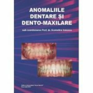 Anomaliile dentare si dento-maxilare - Ecaterina Ionescu imagine