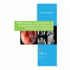 Protocoale diagnostice si terapeutice in patologia tumorala etmoidala - Cristina Stoica imagine