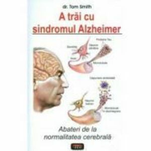 A trai cu sindromul Alzheimer - Tom Smith imagine