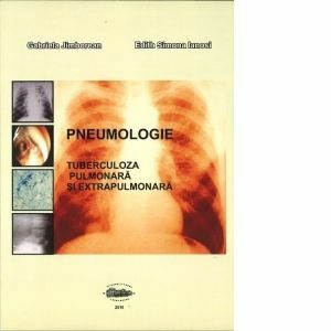 Pneumologie. Tuberculoza pulmonara si extrapulmonara imagine