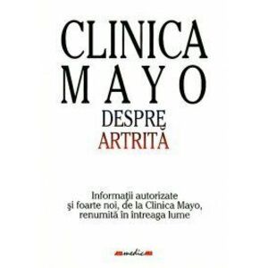Clinica Mayo. Despre artrita imagine