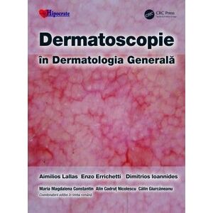 Dermatoscopie in Dermatologia Generala imagine