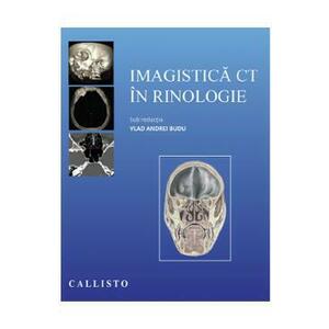 Imagistica CT in rinologie - Vlad Andrei Budu imagine