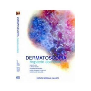 Dermatoscopia. Aspecte esentiale - Robert Johr, H. Peter Soyer imagine