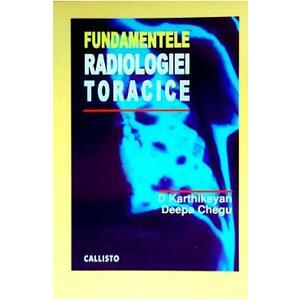 Fundamentele radiologiei toracice - D. Karthikeyan, Deepa Chegu imagine