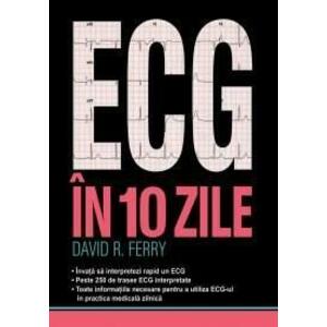 ECG in 10 zile | David R. Ferry imagine