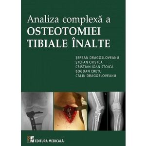 Analiza complexa a osteotomiei tibiale inalte | Serban Dragosloveanu imagine