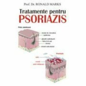 Tratamente pentru psoriazis - Prof. dr. Ronald Marks imagine